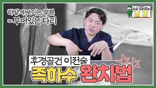 “이 수술하신 후에 슬리퍼를 신을 수 있는 게 가장 좋대요”｜족하수 완치법(후경골건 이전술 케이스)｜수술 읽어주는 남자👨‍⚕️