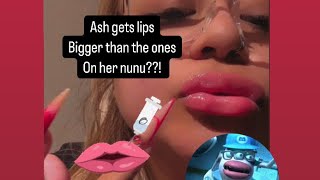 Ash gets her lips done again?! 🤡👀 #ashtrevino #live #funny #nunu