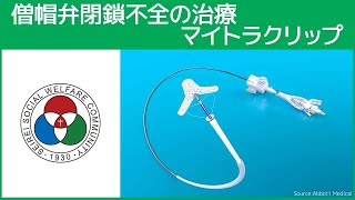 「循環器センター」僧帽弁閉鎖不全の治療 マイトラクリップ（白いまどNo.511）@SeireiHamamatsu