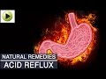 Acid Reflux (Acidity) - Natural Ayurvedic Home Remedies Acid Reflux (Acidity) - Natural Ayurvedic Home Remedies