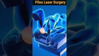 Piles Laser Surgery l 3D animation #shorts #viral #piles #3d