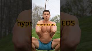 Hypermobile EDS @whealth_ #stayflexy