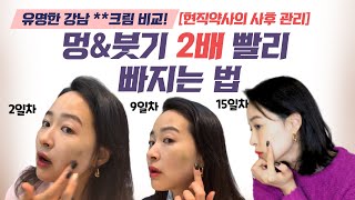 시술 애프터케어 : 얼굴 희생하여 멍크림2종 비교