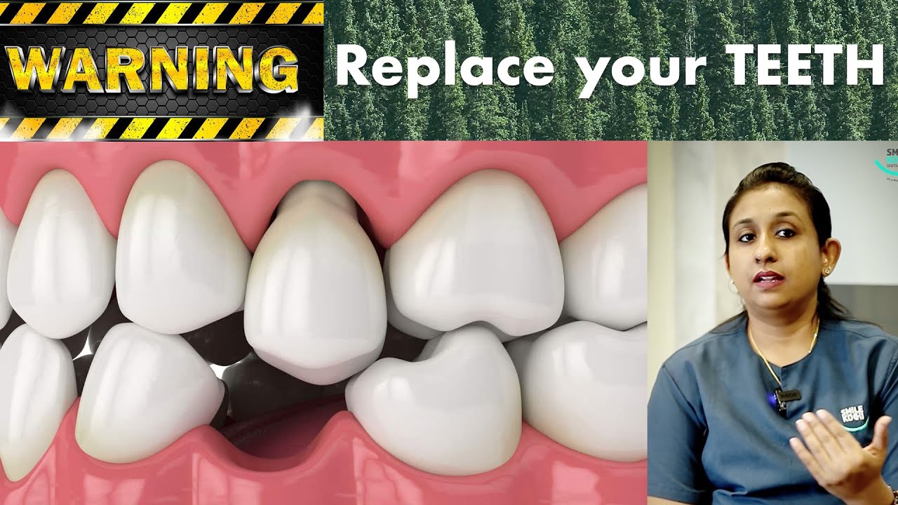 Dental Implant Youtube