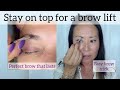 Stay on top for a brow lift