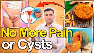 How To Treat Polycystic Ovarian Syndrome and Eliminate Pain or Cysts