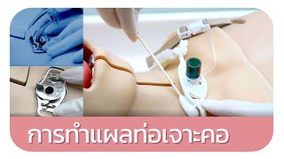 การทำแผลท่อเจาะคอ