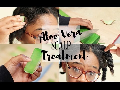 HOW TO STOP DRY SCALP & DANDRUFF | Aloe Vera Scalp Treatment HOW TO STOP DRY SCALP & DANDRUFF | Aloe Vera Scalp Treatment