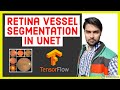 Retina Blood Vessel Segmentation using UNET in TensorFlow 2.0 (Keras) | Image Segmentation