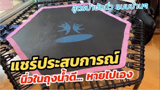 วิธีสลายนิ่วในถุงน้ำดี แบบธรรมชาติบำบัด (แบบบ้านๆ ประสบการณ์ตัวเองเท่านั้น) สมุนไพรพื้นบ้านนะครับ