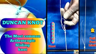 DUNCAN KNOT | Most common Arthroscopic Sliding knot | knot pushing \u0026 Pass pointing Technique 🔥🔥