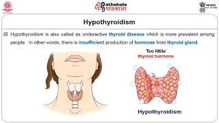 M-27.How to overcome hyperthyroidism and hypothyroidism?
