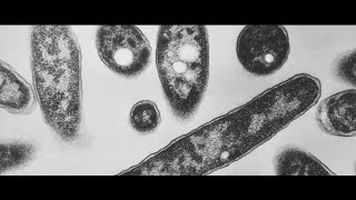 NYC Legionnaires’ Disease death toll climbs to 4