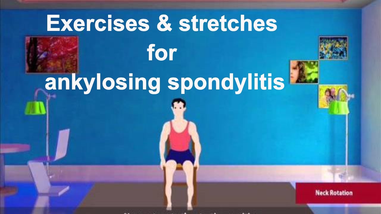 Stretches & Exercises For Ankylosing Spondylitis - YouTube