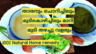 താരൻ മാറും മുടിവളരുകയും ചെയ്യും/Dandruff treatment at home/natural home remedy/Best result(ep:30).