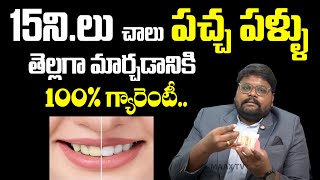 Just 15 Minutes for Teeth whitening | 15ని.లో పచ్చ పళ్ళు తెల్లగా | Teeth whitening treatment