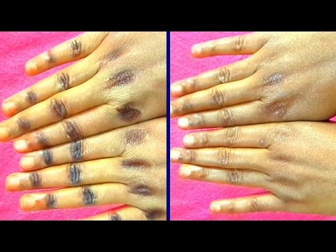 WAYS TO GET RID OF DARK KNUCKLES |HOME REMEDY WORK 100% WAYS TO GET RID OF DARK KNUCKLES |HOME REMEDY WORK 100%