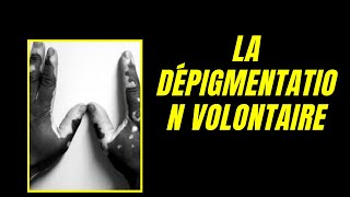 La Dépigmentation Volontaire : une Bombe à Retardement