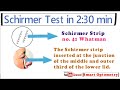 Schirmer test - Dry Eye within 2:30 min