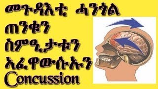 #መጉዳእቲ #ሓንጎል ጠንቁን ስምዒታቱን ኣገባብ ኣፈዋውሱኡን ምክልኻሉን #Concussion Causes Symptoms, treatment \u0026 its prevention