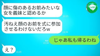 姉の結婚式で、傷のある顔の私を新郎が蹴り飛ばして追い出した。「汚い顔の女は式に出さない」と言って。