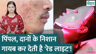 क्या है Red Light Therapy जो Hair Loss, Pimples, Scars ठीक कर सकती है? | Sehat ep 1070