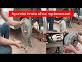 Hyundai brake shoe replacement Hyundai i10 break shoe price Hyundai break pad change jahirul break#