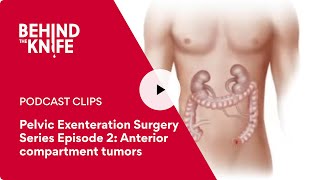 Pelvic Exenteration Surgery Series Episode 2: Anterior compartment tumors