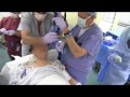 severe arthritic syndrome awake intubation from aod