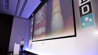 3D-Printing Dentists are Recreating Entire Jaws | Health | WIRED