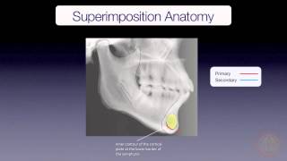 Mandibular Superimposition