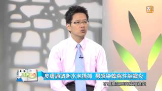 20130930【健康日記GoGo Health】第六十六集-蜂窩性組織炎 part 2