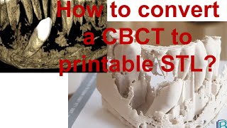 How to convert a CBCT to a printable STL file for free?