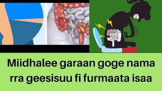 Garaan goge rakkoolee akkami akka nama rra geesisuu fi furmaata isaa karaa salphaa dhan