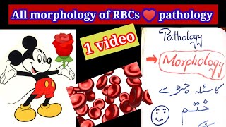 RBCs pathologies in 1 video. 🔴. #anemia #types of anemia