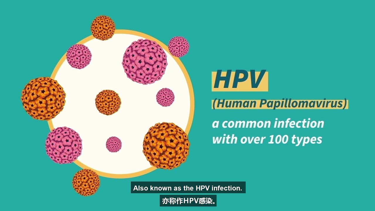 Cervical Cancer Screening (Pap Test / HPV Test) - YouTube