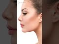 What is Rhinoplasty | Reasons for getting Rhinoplasty Surgery | Nose Job | Dr Preeti Yadav