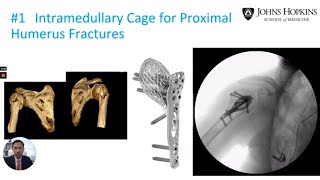 Emerging Technologies in Shoulder Surgery | Dr. Srikumaran