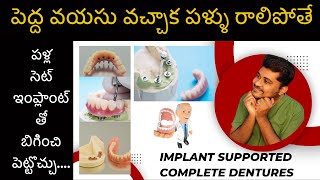 Implant Supported Complete Dentures In Old People || పెద్ద వయసు వాలకి గొప్ప వరం ఇంప్లాంట్ రూపంలో ||