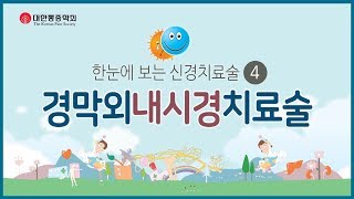 '경막외내시경치료술'이란?  |  4분 애니