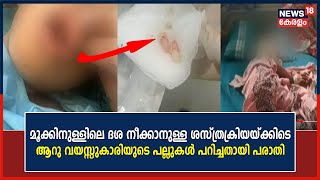 മൂക്കിനുള്ളിലെ ദശ നീക്കാനുള്ള ശസ്ത്രക്രിയയ്ക്കിടെ ആറു വയസ്സുകാരിയുടെ പല്ലുകൾ പറിച്ചതായി പരാതി