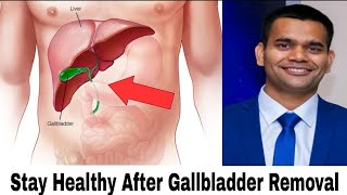 How To Live Healthy Life After Gallbladder Removal | Dr.Vivek Joshi