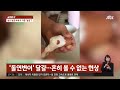 삶은 달걀 속에 또 다른 달걀 이 … 돌연변이 이중 달걀 jtbc 사건반장