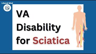 VA Disability Claim for Sciatica🦵 | DBQ, C&P, Rating| #veterans #vadisability #vaclaims #vabenefits