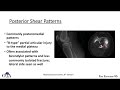 tibia plateau fractures lecture 1 ota ccv5