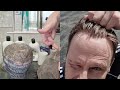 How to Tape Hair Replacement System. with Bleached Knots. How to Use Positioning Spray To Attach