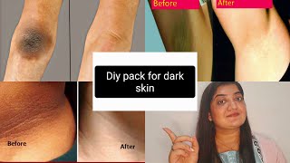 કાળી પડી ગયેલ skin માટે સરળ ઉપાય/diy pack for darkened skin of neck, underarms etc #diypack