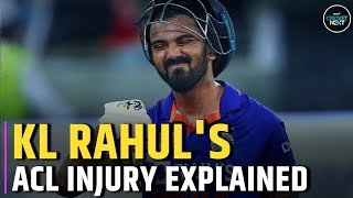 KL Rahul's ACL Injury: Explainer, How Difficult Was it to Cure KL Rahul's ACL Injury? | CricketNext