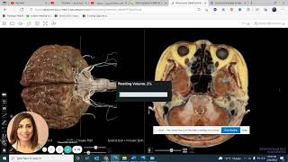 Anatomage: High Resolution Brain- Version 8