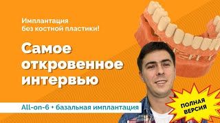 Все на 6 и базальная имплантация. Отзыв пациента подробный